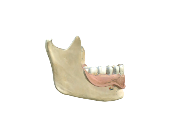 1000016 D16 Giant Dental Model with skin Teil2 OPT