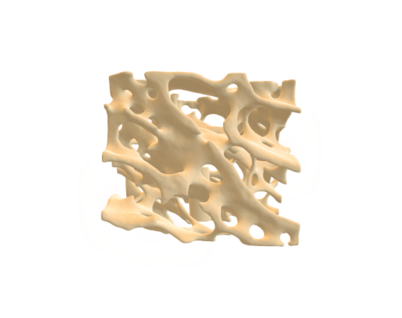 1009698 A99 Human Cancellous Bone Model
