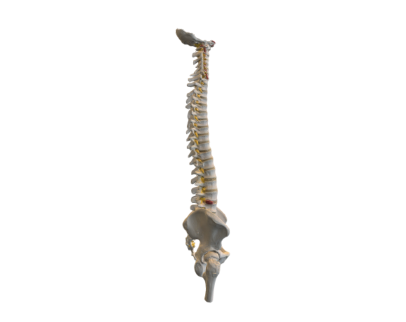 1000122 A59-2 Flexible Spine with Femur Heads opt