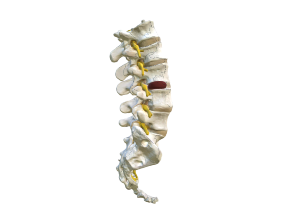 1000150 A76-5 Lumbar Spinal Column opt