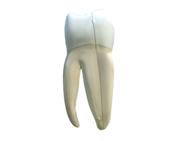 1013215 D15 giant molar tooth full optimized